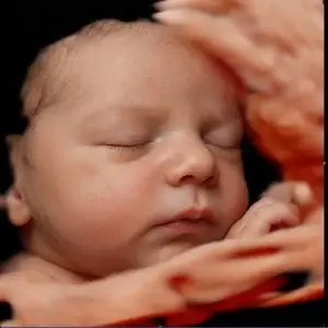 Ecografía 8K Hiperrealista